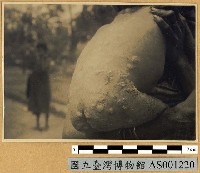 藏品(新幾內亞風土病寫真-Framboesia)的圖片